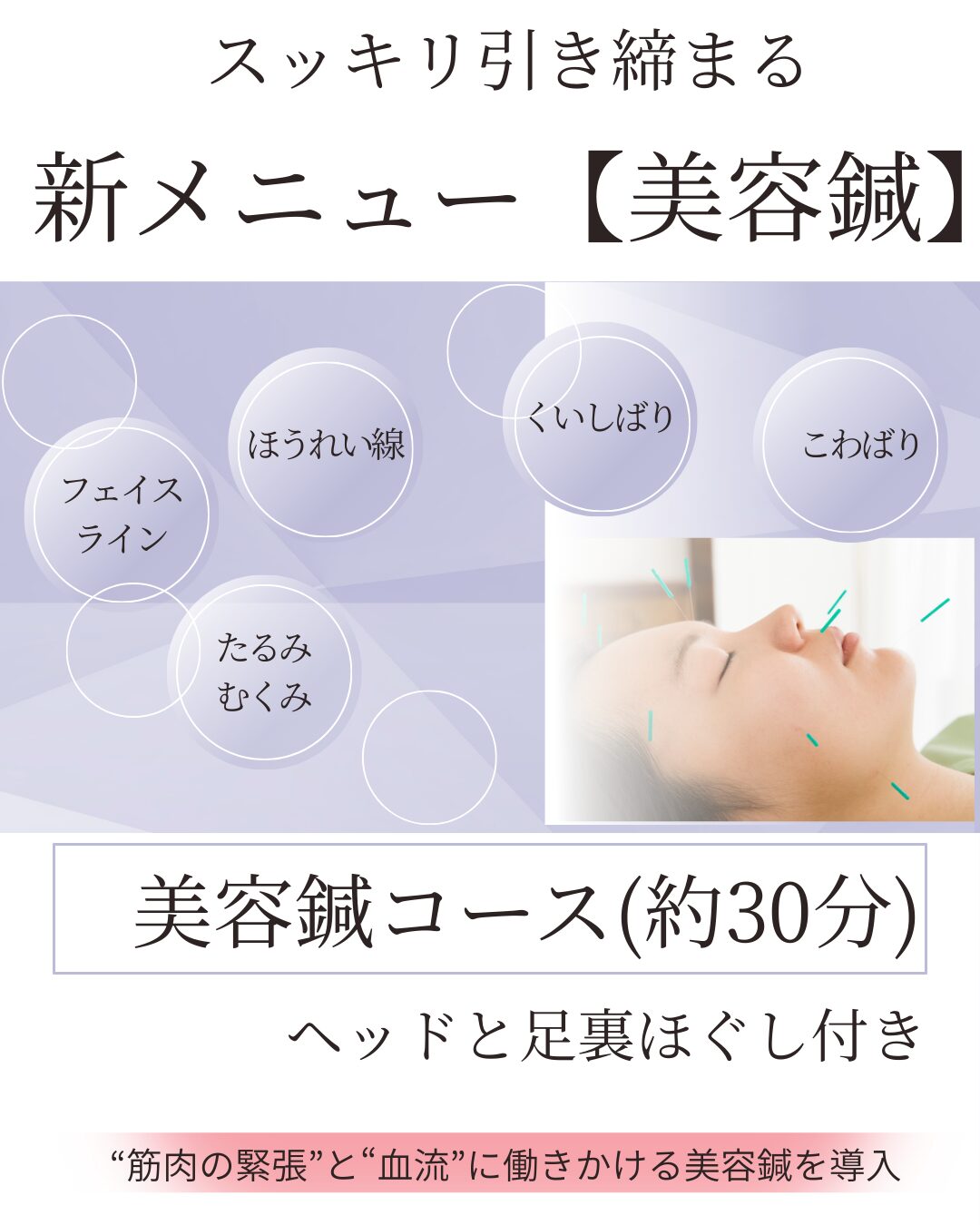 美容鍼はじめました