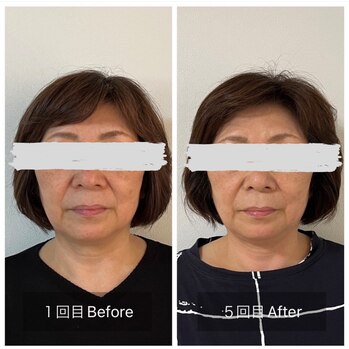 3.21 鍼灸院 はりのひと（継続が鍵！）