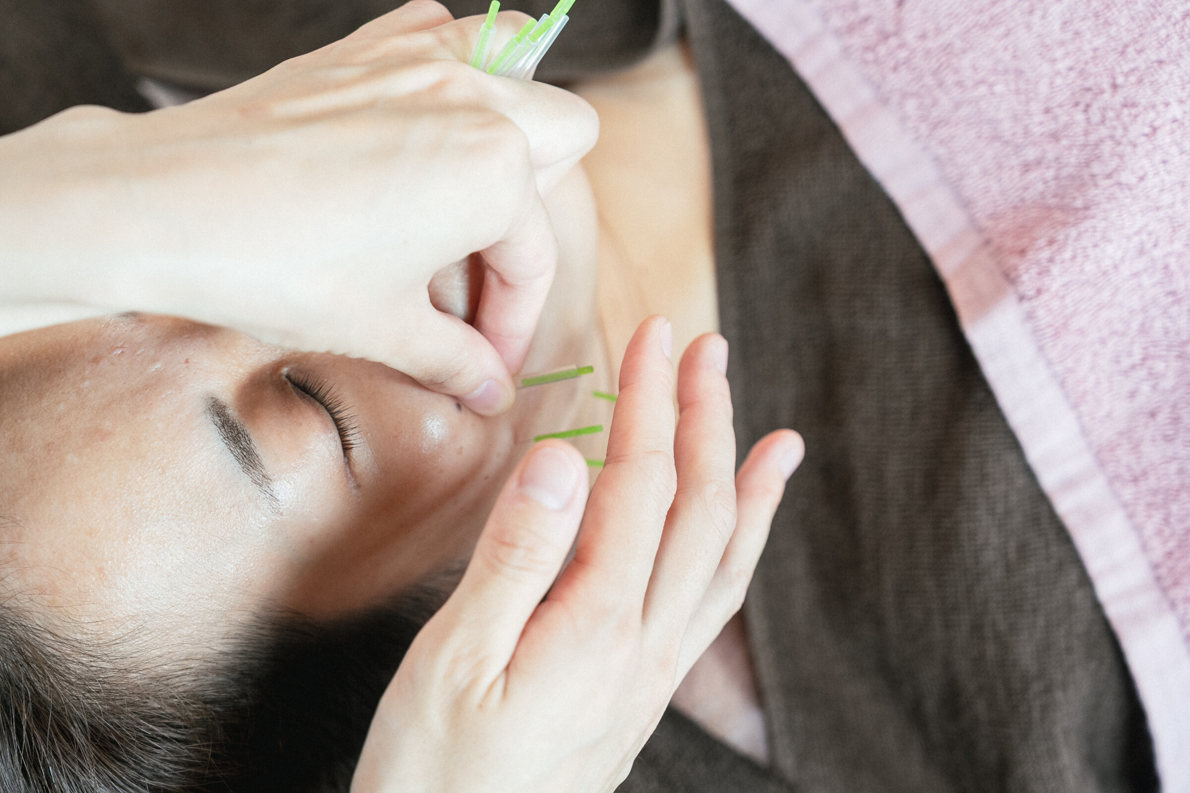 4.3 鍼灸院 はりのひと（美容鍼）